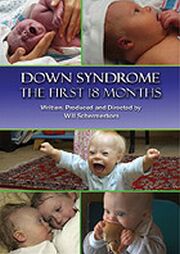 down syndrome the first 18 months dvd